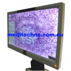 HD1500TM Digital Imaging system